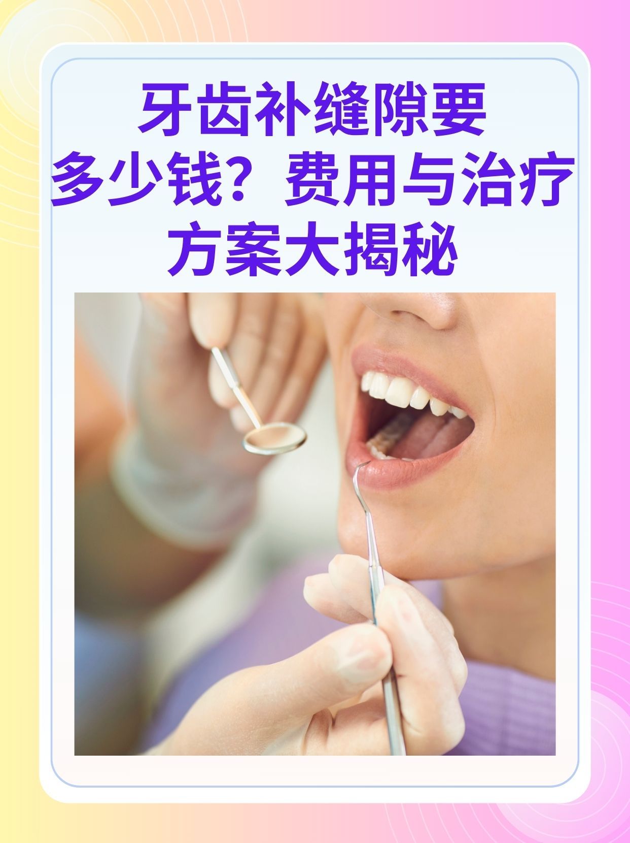 辽阳补牙医保可以报销吗(补牙医保可以报销吗 哪些可以报销呢)